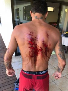 Filipe Toledo machuca a costas ao chocar-ser contra a nacada de coral, durante os treinos para o Tahiti Pro Teahupoo.