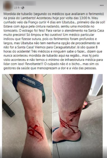 Ataque tubarão, Ubatuba (SP)