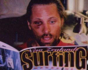Viggo de olho roxo descobrindo que surfar também machuca.